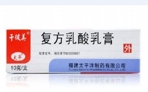 复方乳酸乳膏